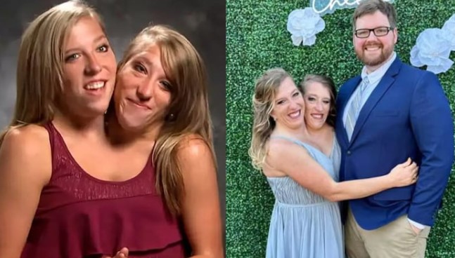 Conjoined Sisters Abigail, Brittany Hensel Tie the Knot
