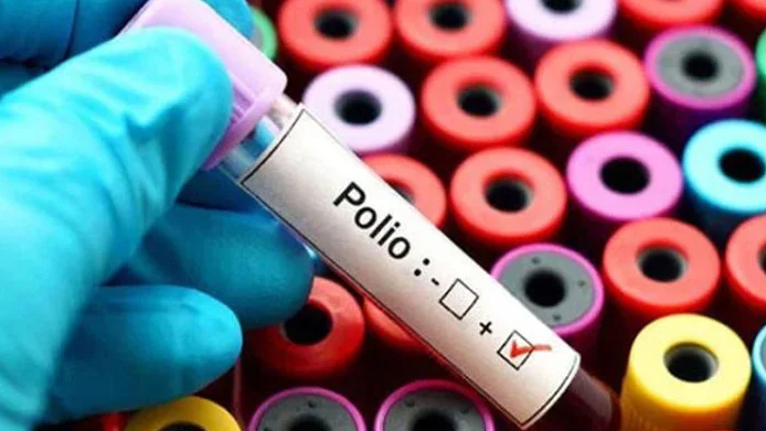 Poliovirus Allegedly Detected in Dirty Water in Mirpur Khas